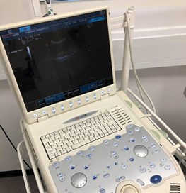 Billede af ultralydsapparat 